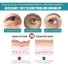 EELHOE Spirulina Boost, Repair Eye Bags, Dark Circles And Moisturizing Elastic Muscle Massage Treatment Around The Eyes