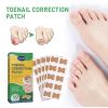 Jaysuing Toenail Furrow Correction, Toenail Insert Nail Repair Correction Pull-up Nail Nail Patch