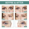 EELHOE Firming Eye Cream Stick Deeply Moisturizes And Smooths Wrinkles, Strengthens And Smooths Skin, Hydrates And Moisturizes