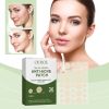 OUHOE Anti-Acne Patch, Gentle Cleansing Helps Relieve Facial Blemishes Appearance Concealer Breathable Facial Care Patch