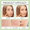 OUHOE Anti-Acne Patch, Gentle Cleansing Helps Relieve Facial Blemishes Appearance Concealer Breathable Facial Care Patch